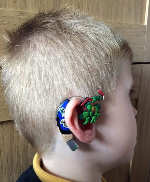 hearing-aid-decorations-kids-cochlear-implant-sarah-ivermee-lugs-3 | My ...